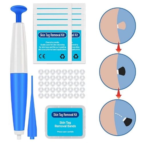 Skin Tag Remover Kit