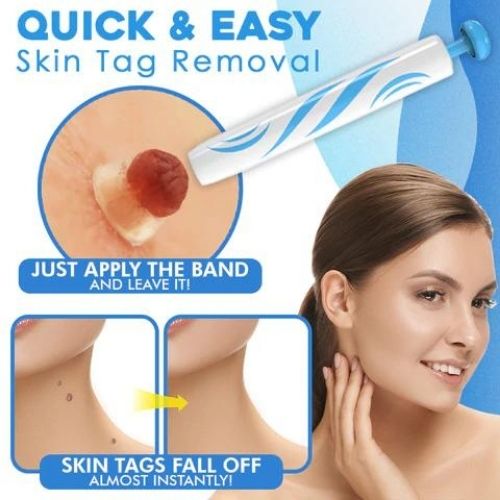 Skin Tag Remover Kit