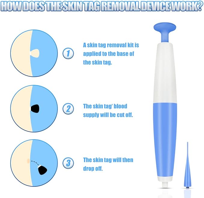 Skin Tag Remover Kit