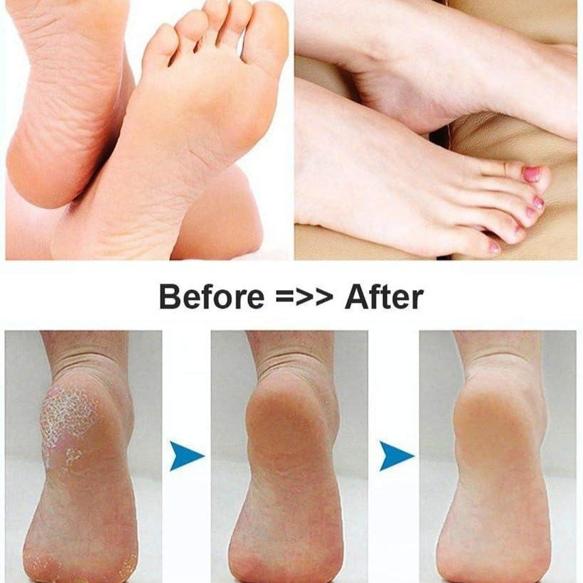 Electric Foot Scrubber & Callus Remover